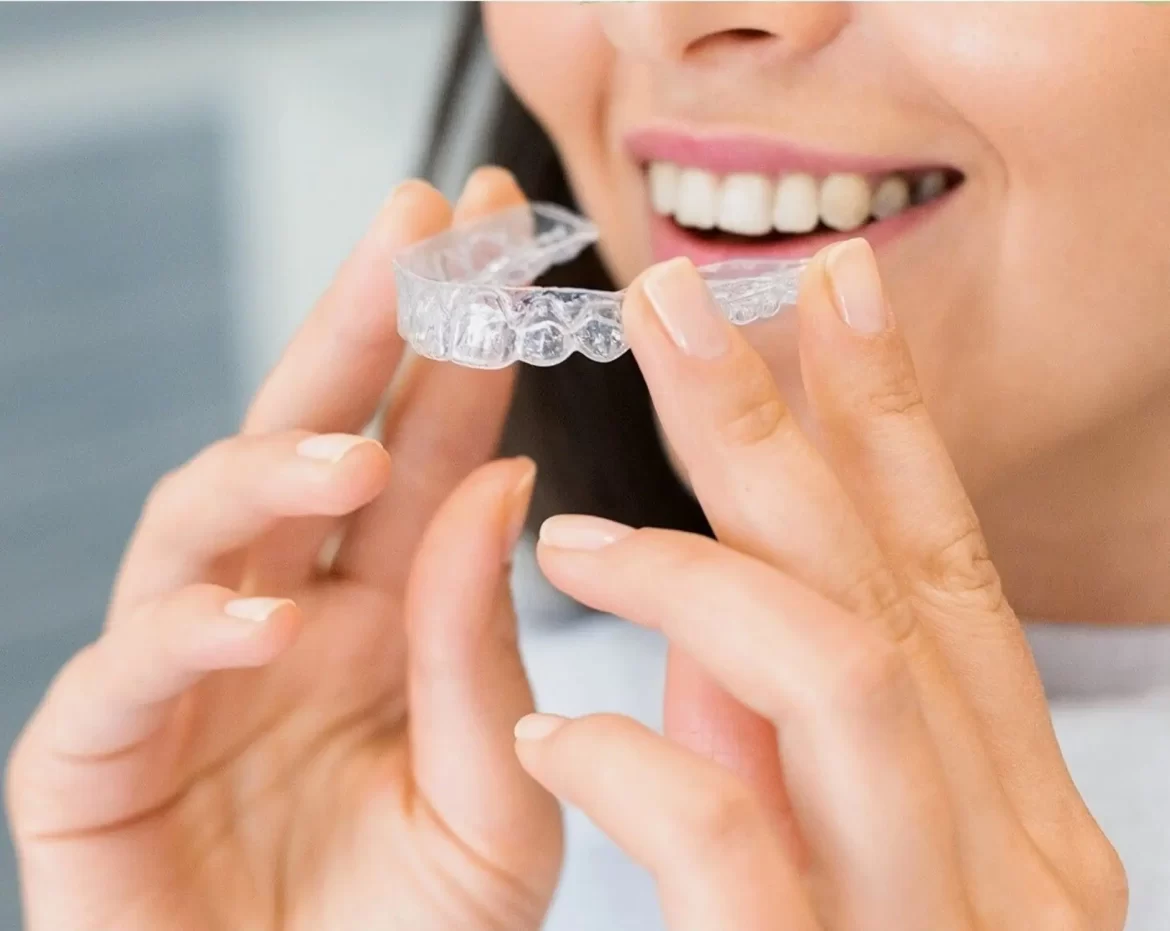 Clear Braces vs Metal Braces