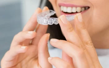 Clear Braces vs Metal Braces